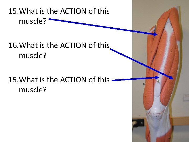 15. What is the ACTION of this muscle? 16. What is the ACTION of