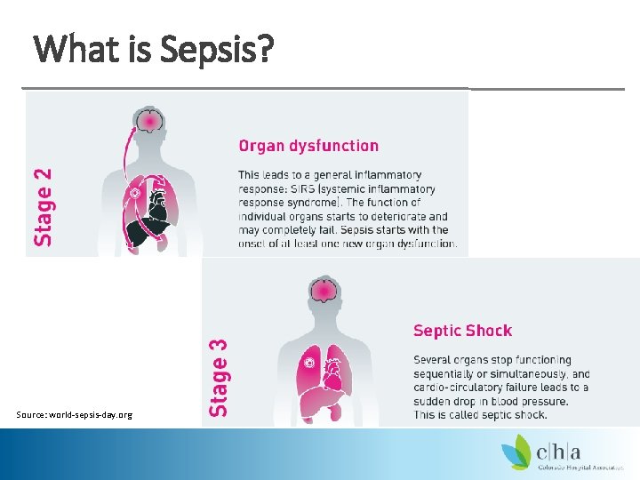 What is Sepsis? Source: world-sepsis-day. org 