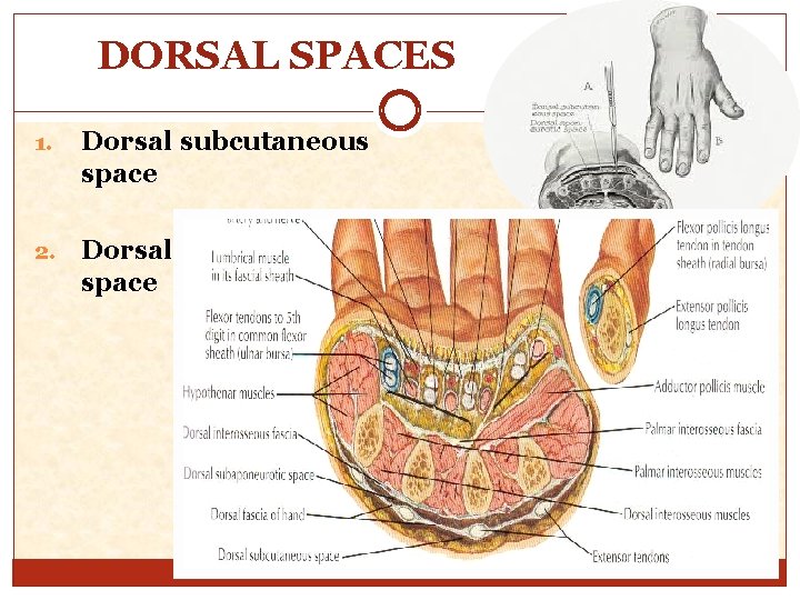 DORSAL SPACES 1. Dorsal subcutaneous space 2. Dorsal subaponeurotic space 