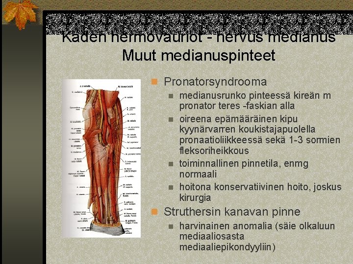 Käden hermovauriot - nervus medianus Muut medianuspinteet n Pronatorsyndrooma n medianusrunko pinteessä kireän m