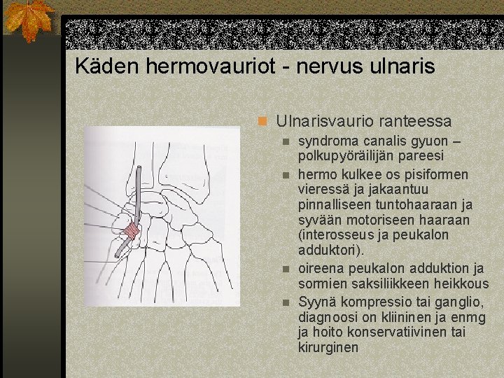 Käden hermovauriot - nervus ulnaris n Ulnarisvaurio ranteessa n syndroma canalis gyuon – polkupyöräilijän
