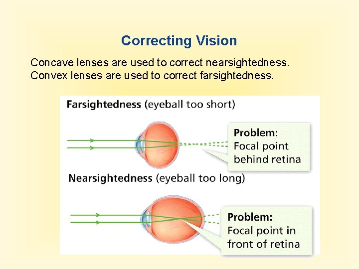 Correcting Vision Concave lenses are used to correct nearsightedness. Convex lenses are used to