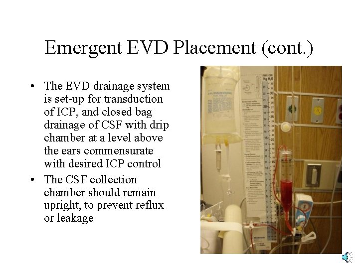 Emergent EVD Placement (cont. ) • The EVD drainage system is set-up for transduction