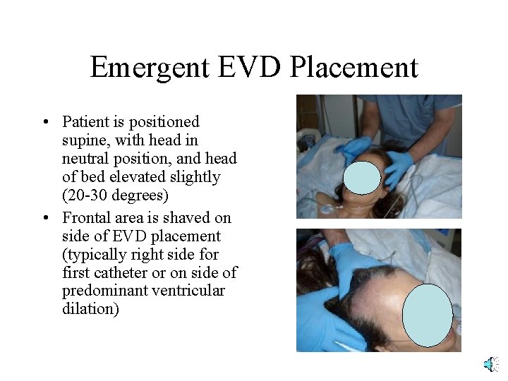 Emergent EVD Placement • Patient is positioned supine, with head in neutral position, and