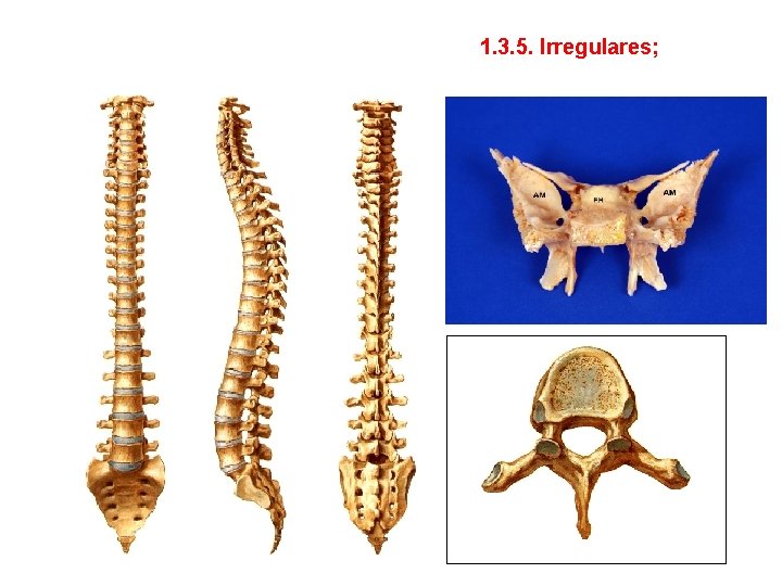 1. 3. 5. Irregulares; 