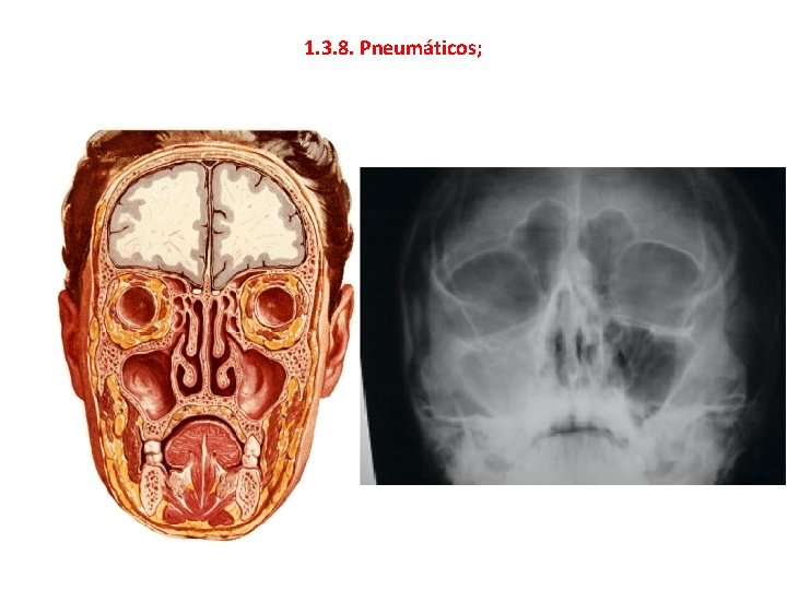1. 3. 8. Pneumáticos; 