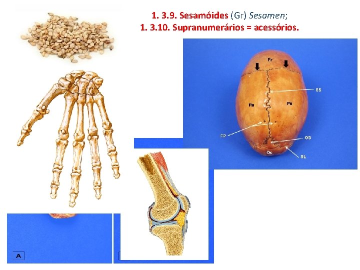 1. 3. 9. Sesamóides (Gr) Sesamen; 1. 3. 10. Supranumerários = acessórios. 