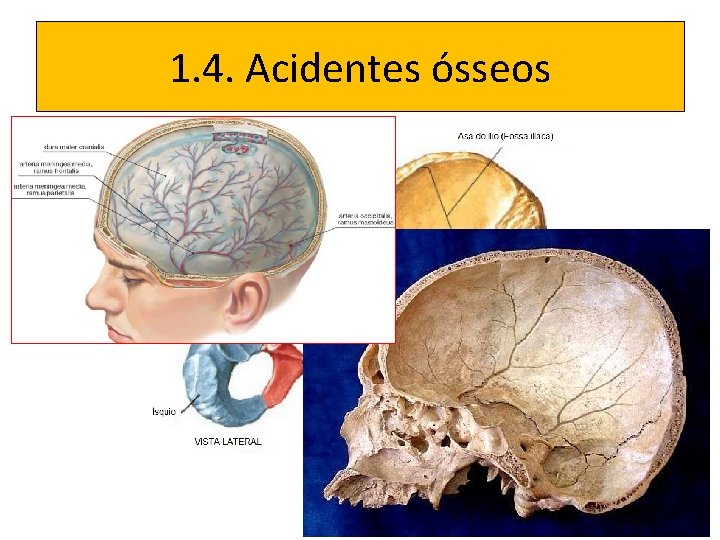 1. 4. Acidentes ósseos 