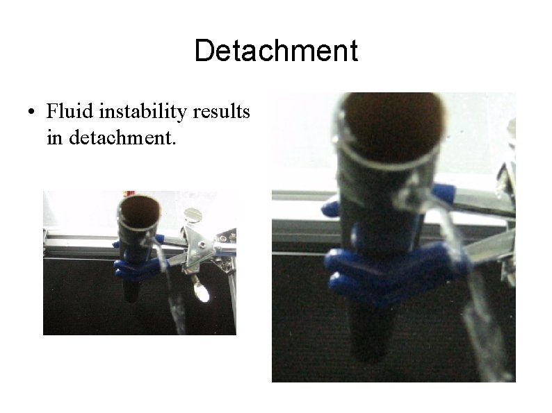 Detachment • Fluid instability results in detachment. 