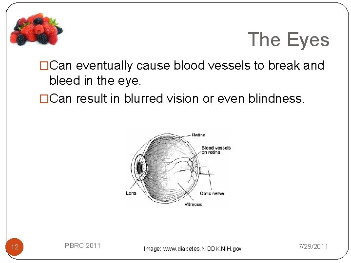 The Eyes �Can eventually cause blood vessels to break and bleed in the eye.