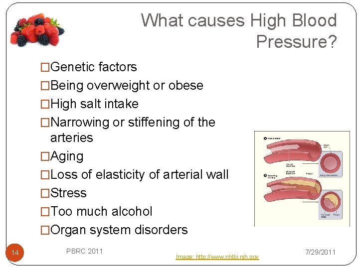 What causes High Blood Pressure? �Genetic factors �Being overweight or obese �High salt intake