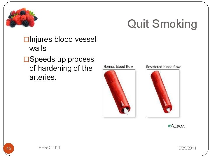 Quit Smoking �Injures blood vessel walls �Speeds up process of hardening of the arteries.