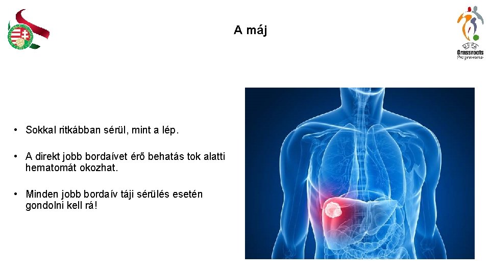 A máj • Sokkal ritkábban sérül, mint a lép. • A direkt jobb bordaívet