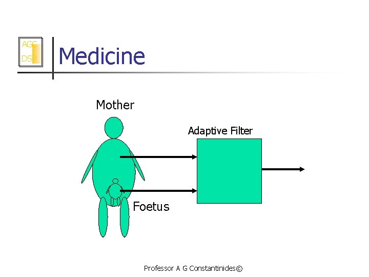 AGC DSP Medicine Mother Adaptive Filter Foetus Professor A G Constantinides© 