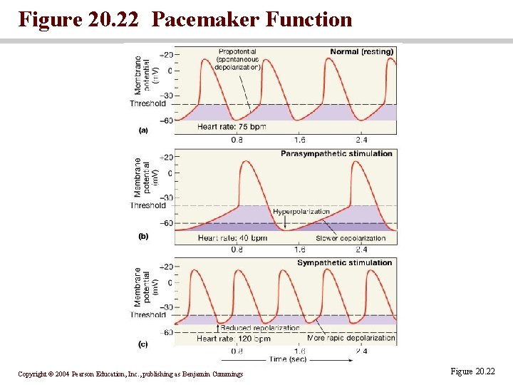 Figure 20. 22 Pacemaker Function Copyright © 2004 Pearson Education, Inc. , publishing as