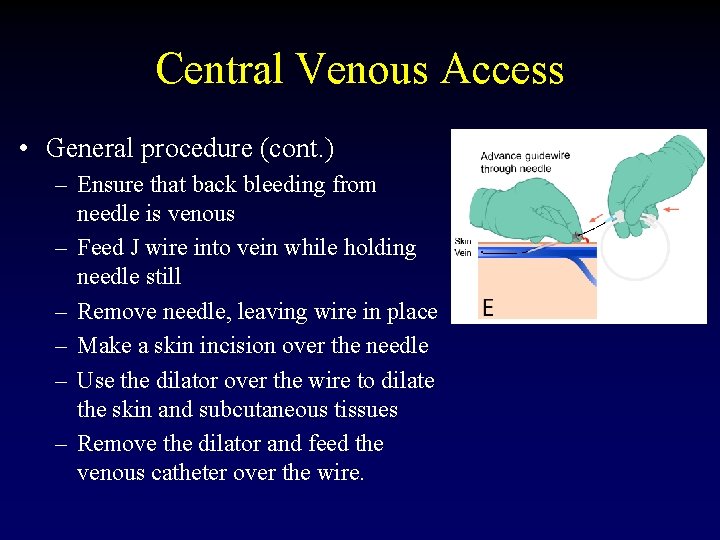 Central Venous Access • General procedure (cont. ) – Ensure that back bleeding from