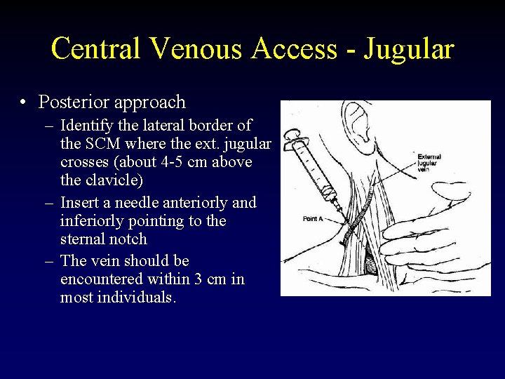 Central Venous Access - Jugular • Posterior approach – Identify the lateral border of