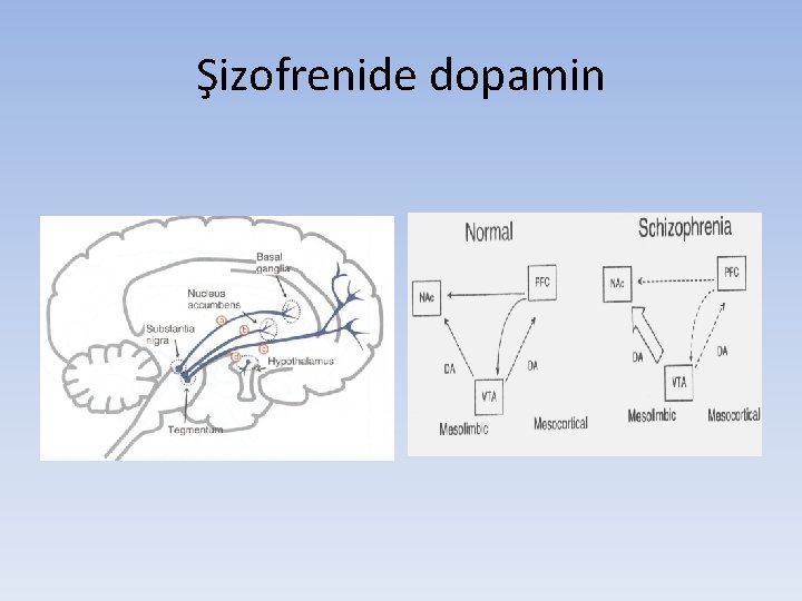 Şizofrenide dopamin 
