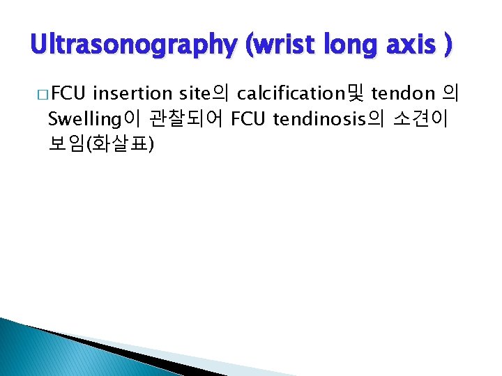 Ultrasonography (wrist long axis ) � FCU insertion site의 calcification및 tendon 의 Swelling이 관찰되어