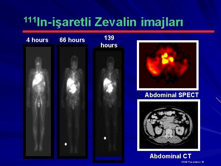 111 In-işaretli 4 hours 66 hours Zevalin imajları 139 hours Abdominal SPECT Abdominal CT