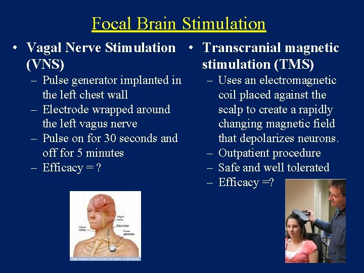 Focal Brain Stimulation • Vagal Nerve Stimulation • Transcranial magnetic (VNS) stimulation (TMS) –