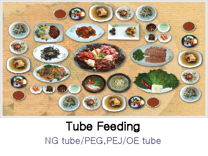 Tube Feeding NG tube/PEG, PEJ/OE tube 