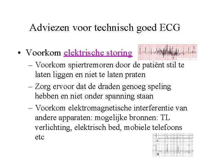 Adviezen voor technisch goed ECG • Voorkom elektrische storing – Voorkom spiertremoren door de
