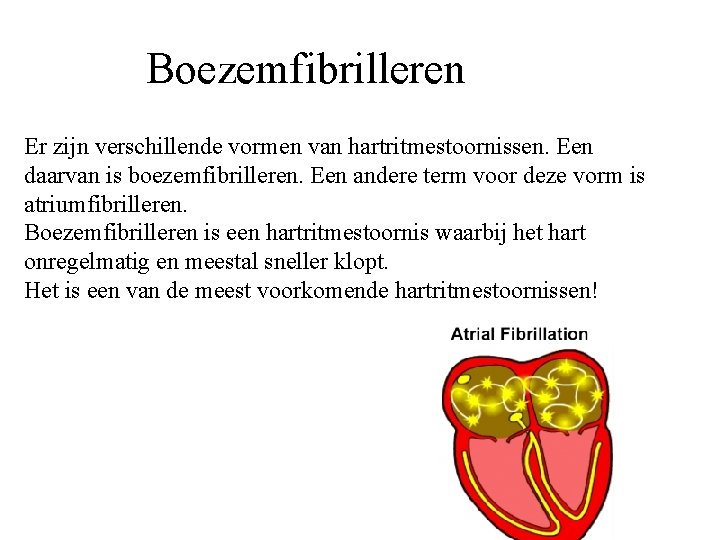 Boezemfibrilleren Boezis één van de meest voorkomende hartritmestoornissen. Er zijn verschillende vormen van hartritmestoornissen.