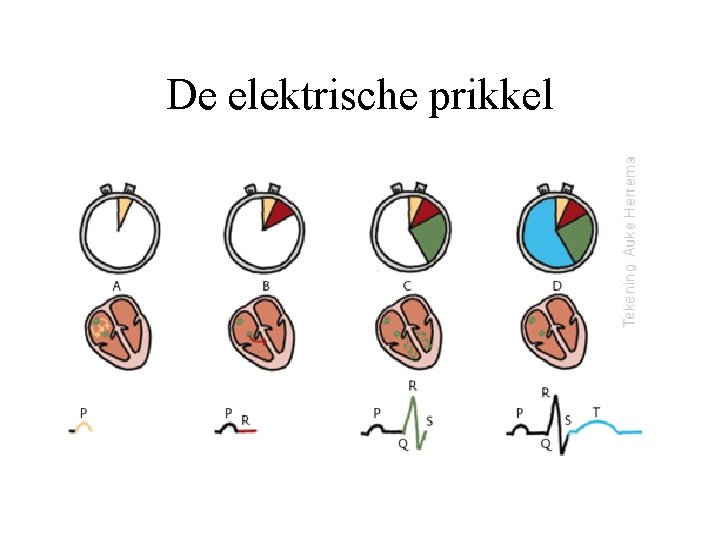 De elektrische prikkel 