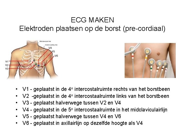 ECG MAKEN Elektroden plaatsen op de borst (pre-cordiaal) • • • V 1 -