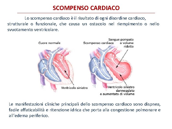 SCOMPENSO CARDIACO Lo scompenso cardiaco è il risultato di ogni disordine cardiaco, strutturale o SCOMPENSO CARDIACO Lo scompenso cardiaco è il risultato di ogni disordine cardiaco, strutturale o