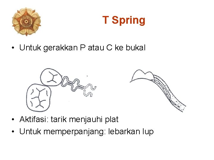 T Spring • Untuk gerakkan P atau C ke bukal • Aktifasi: tarik menjauhi