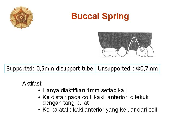 Buccal Spring Supported: 0, 5 mm disupport tube Unsupported : Ф 0, 7 mm