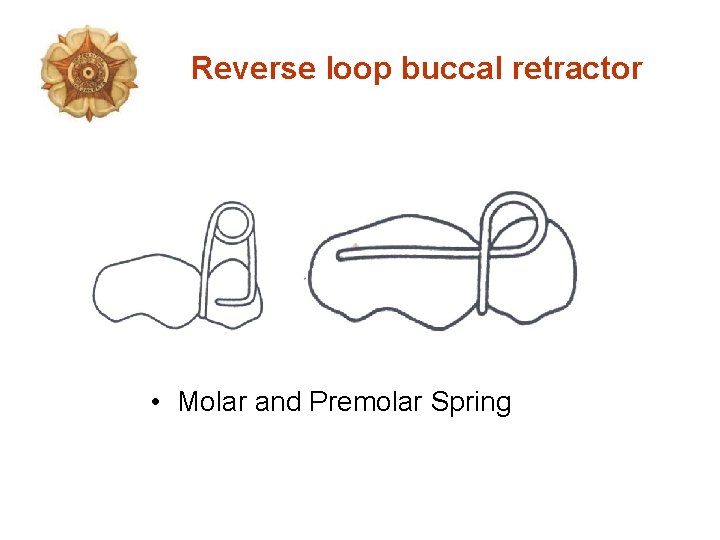 Reverse loop buccal retractor • Molar and Premolar Spring 