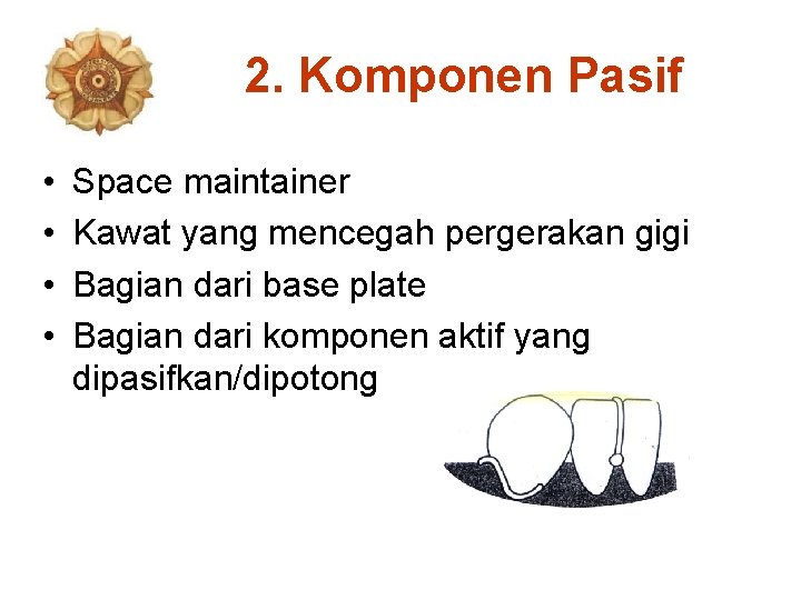 2. Komponen Pasif • • Space maintainer Kawat yang mencegah pergerakan gigi Bagian dari