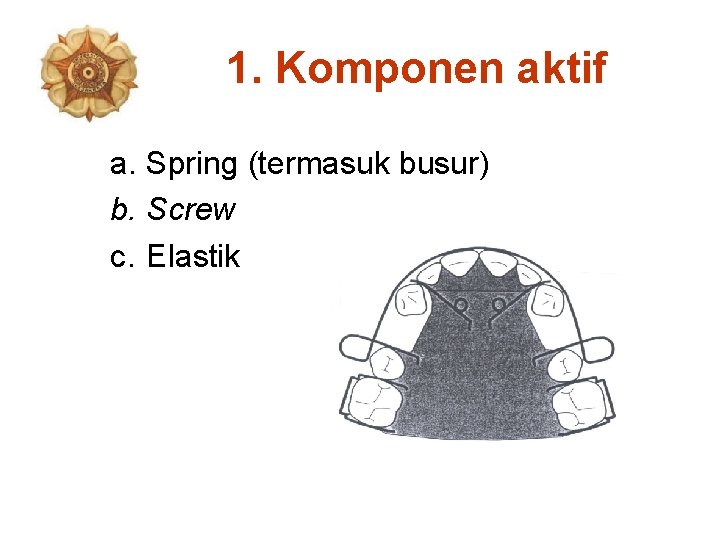 1. Komponen aktif a. Spring (termasuk busur) b. Screw c. Elastik 