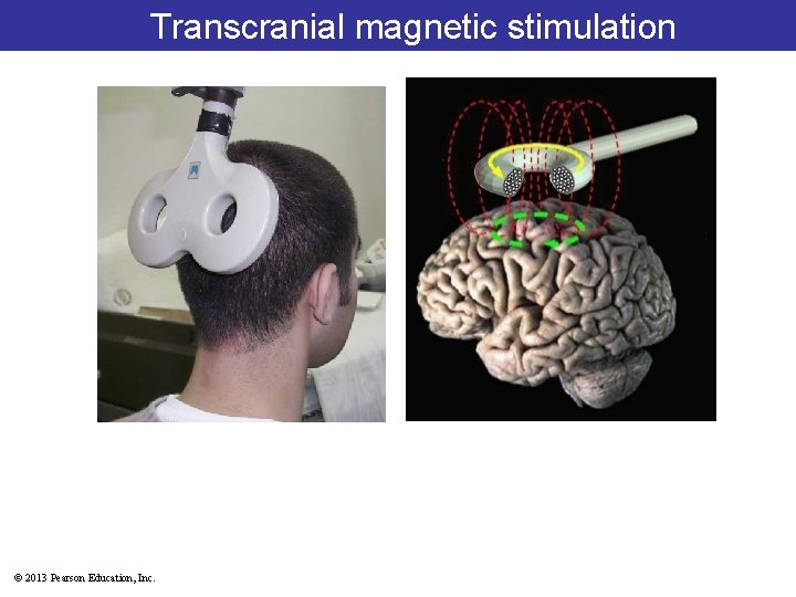 Transcranial magnetic stimulation © 2013 Pearson Education, Inc. 