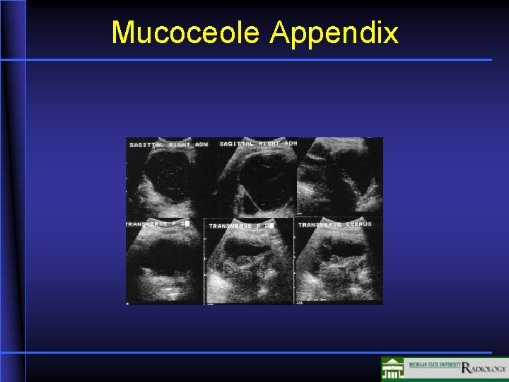 Mucoceole Appendix 