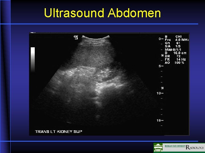 Ultrasound Abdomen 