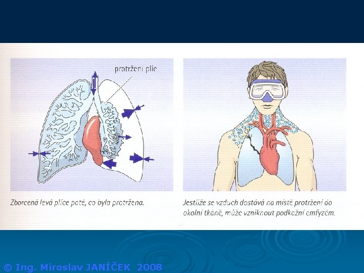 © Ing. Miroslav JANÍČEK 2008 
