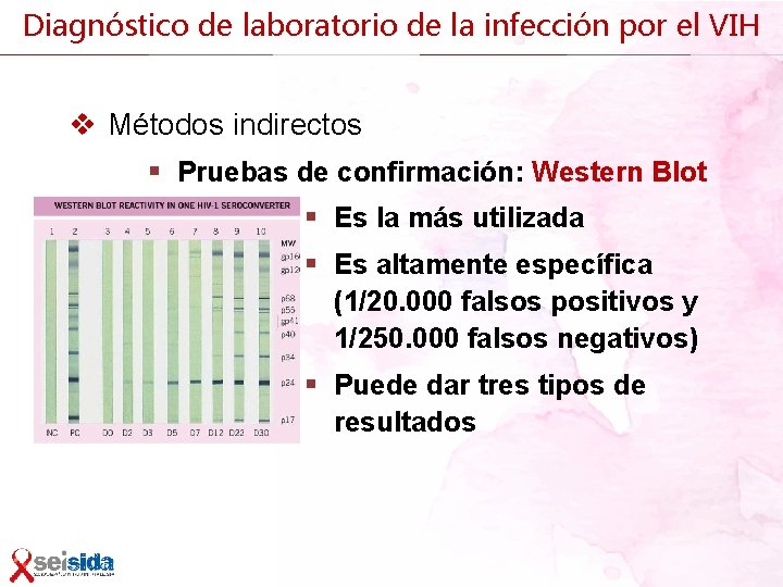 Diagnóstico de laboratorio de la infección por el VIH v Métodos indirectos § Pruebas