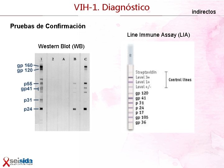 VIH-1. Diagnóstico Pruebas de Confirmación Line Immune Assay (LIA) Western Blot (WB) indirectos 