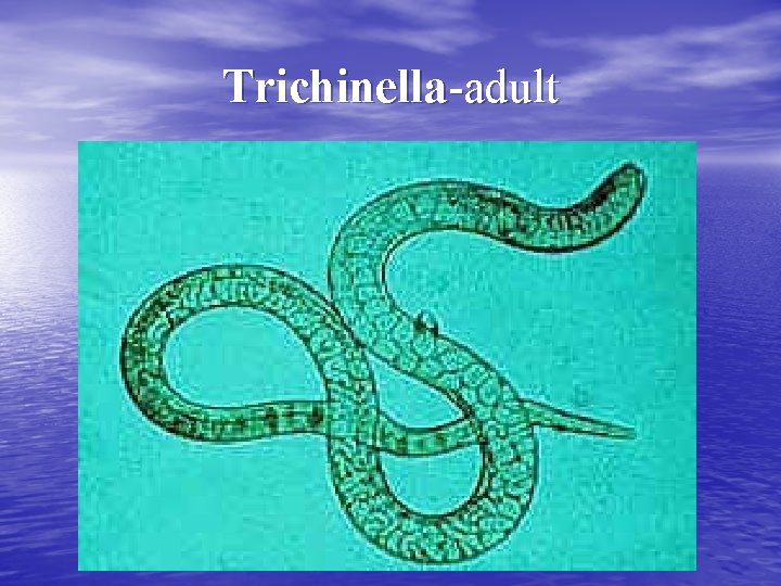 Trichinella-adult 