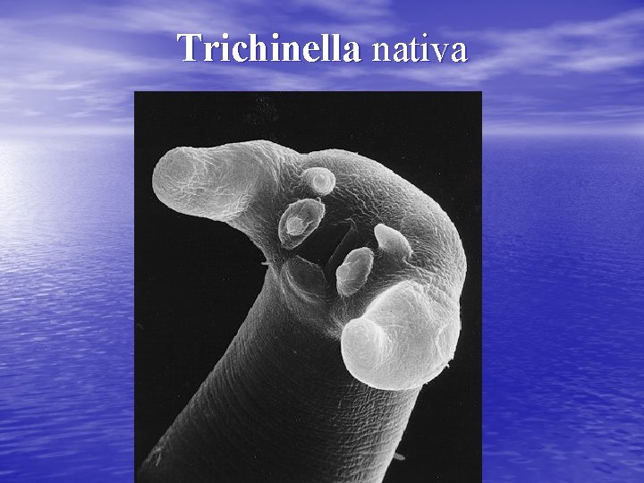 Trichinella nativa 