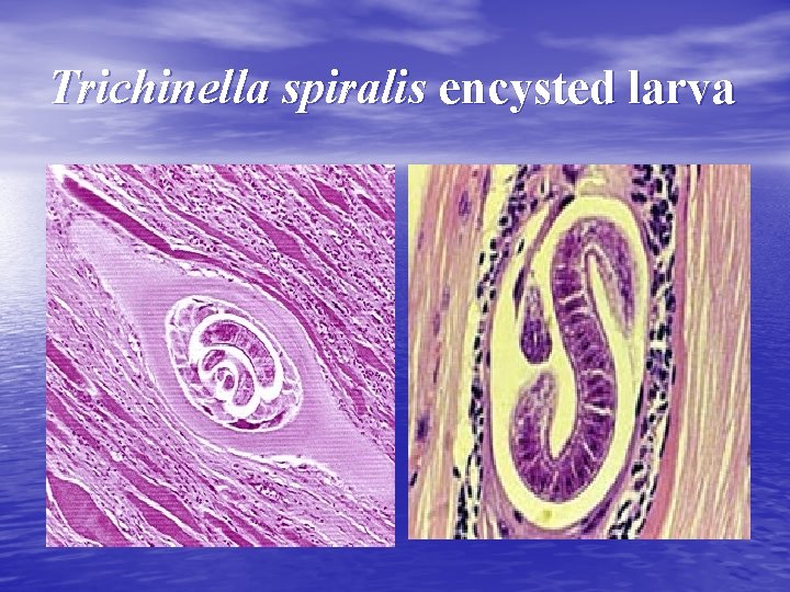 Trichinella spiralis encysted larva 