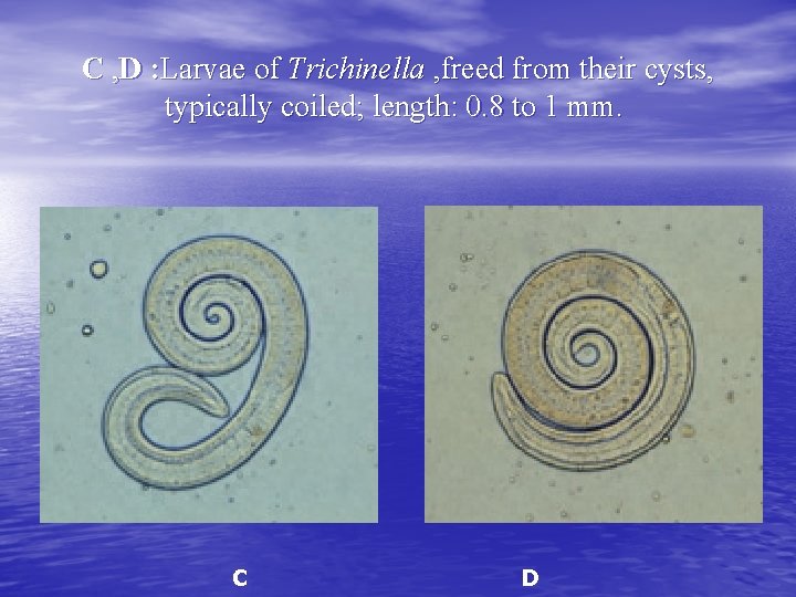 C , D : Larvae of Trichinella , freed from their cysts, typically coiled;