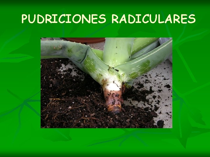 PUDRICIONES RADICULARES 