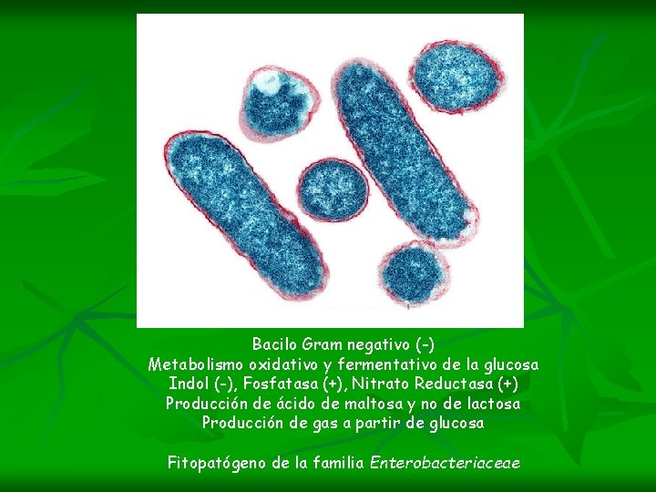 Bacilo Gram negativo (-) Metabolismo oxidativo y fermentativo de la glucosa Indol (-), Fosfatasa