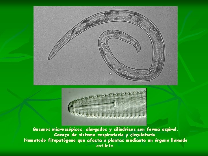 Gusanos microscópicos, alargados y cílindricos con forma espiral. Carece de sistema respiratorio y circulatorio.