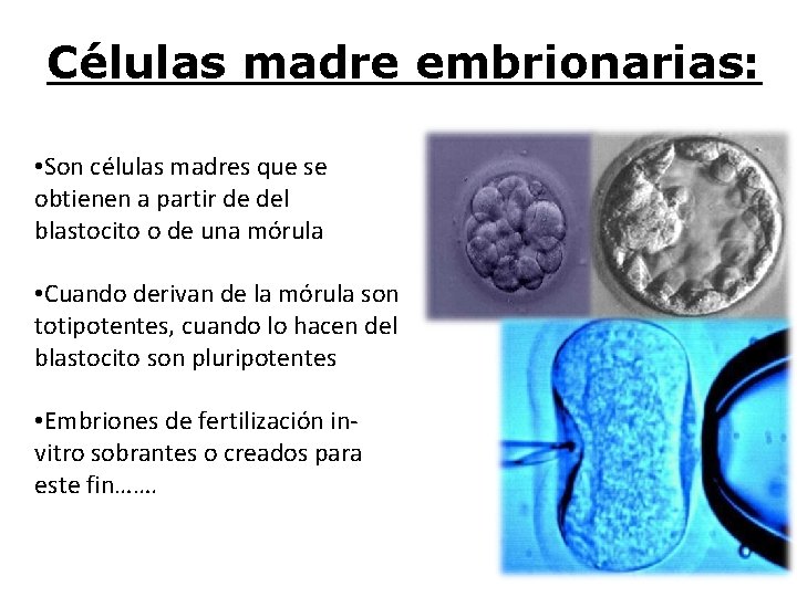 Células madre embrionarias: • Son células madres que se obtienen a partir de del